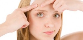 Học cách làm mờ vết thâm do mụn để lại