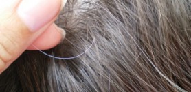 Nguyên nhân bị tóc bạc sớm là gì?