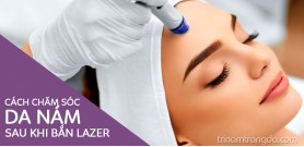 Cách chăm sóc da nám sau khi bắn lazer