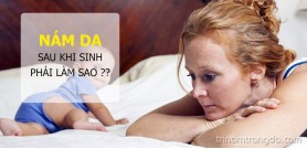 Nám da sau khi sinh phải làm sao?