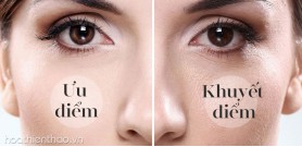 Ưu và khuyết điểm của da nhờn