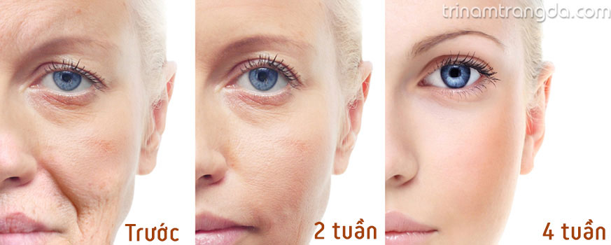 5 Câu hỏi nên hỏi trước khi sử dụng serum dưỡng da 4
