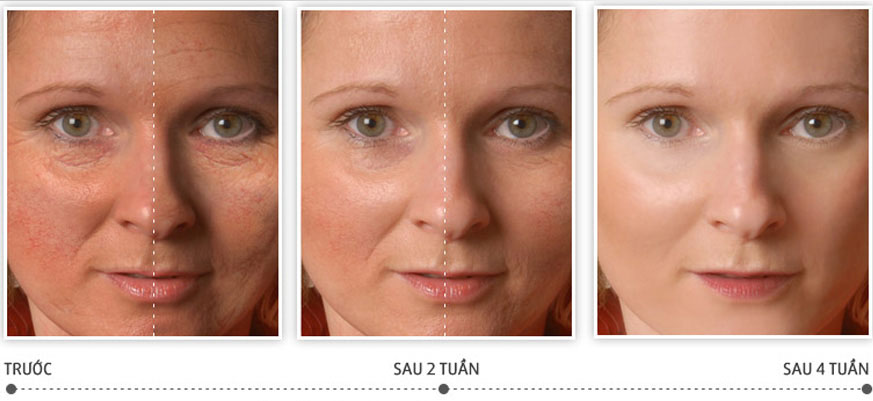 Serum dưỡng trắng da trị nám tốt nhất hiện nay 3