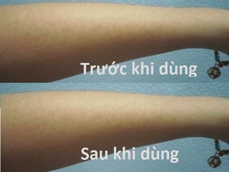 su-dung-kem-tam-trang-hang-gia-hang-tau-gay-hai-cho-da-1