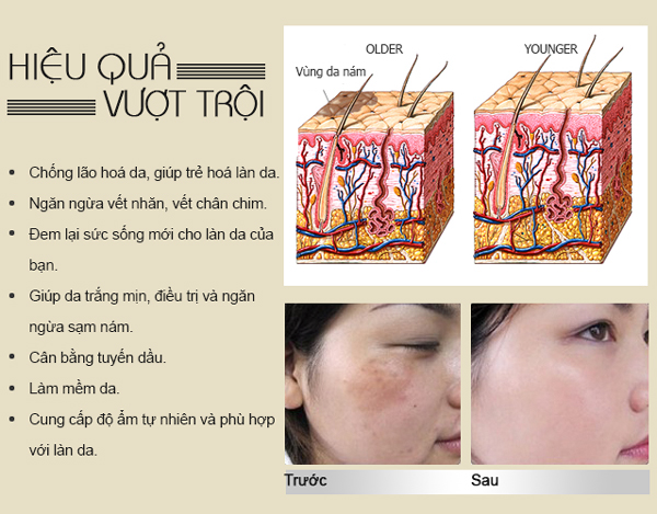 cach-duong-trang-da-sau-khi-dieu-tri-nam-2