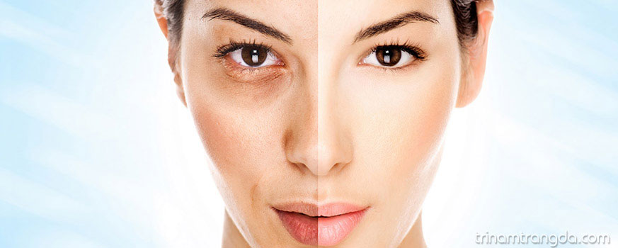 Kem dưỡng trắng da có giúp trị nám không 2