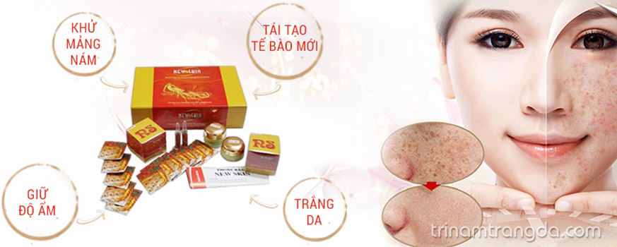 3. Kem trị nám da mặt nào hiệu quả?